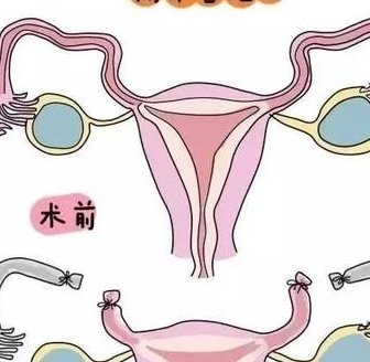 在江苏做试管能助孕吗？费用与成功率你需要提前了解